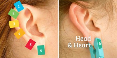 Лечение прищепками по точкам на ушах